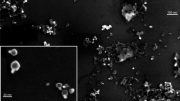 Nanopartículas de cloruro de plata observadas desde un microscopio electrónico