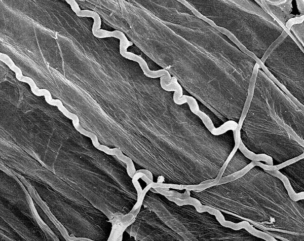 Vista detallada de las hifas del hongo endófito, registradas con un microscopio electrónico de barrido. El hongo sólo crece entre las células vegetales
