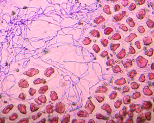Hifas del hongo endófito Epichloë (se aprecian como filamentos) creciendo entre las células en una semilla de pasto