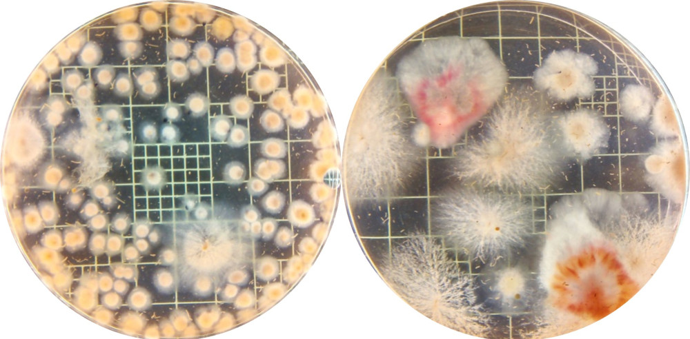 La foto de la izquierda muestra al patógeno F. pseudograminearum proveniente de una planta no micorrizada. A la derecha, detalle del patógeno proveniente de una planta infectada con F. pseudograminearum micorrizada por R. intraradices, en donde se observa una disminución de la presencia del patógeno