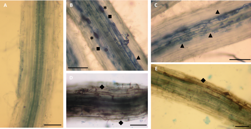 Raíces de trigo con hongos microrrícicos vistas a través del microscopio