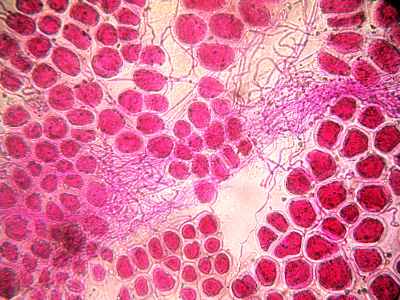 Vista al microscopio de las hifas del hongo endófito (aparecen como hilos retorcidos) creciendo entre las células del raigrás